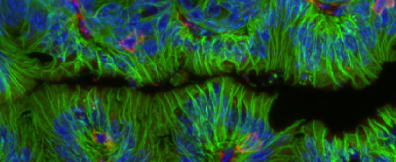 A confocal microscope image showing intestine tissue from a mouse.